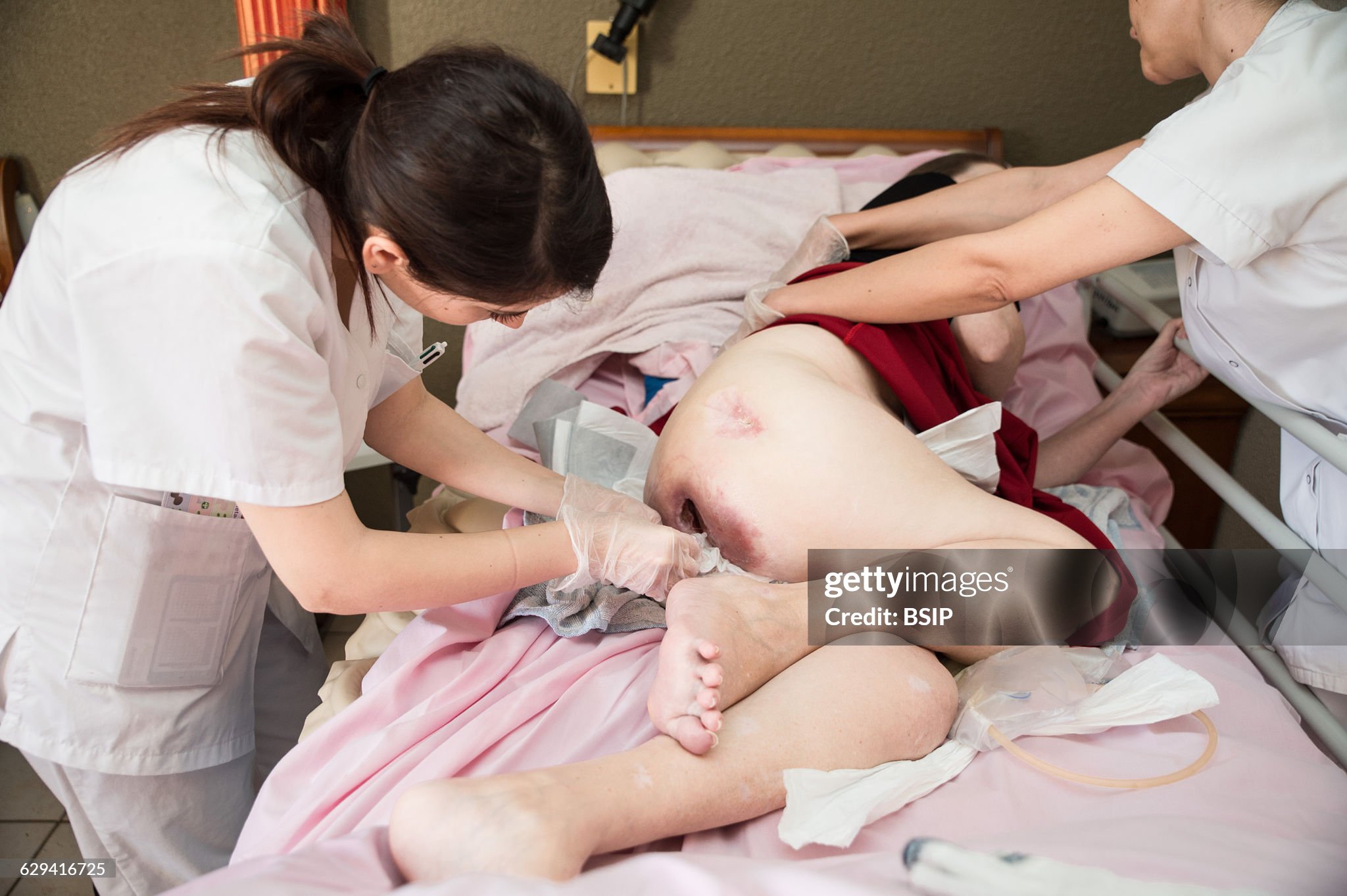 DALLA PREVENZIONE AL TRATTAMENTO DELLE LESIONI DA PRESSIONE