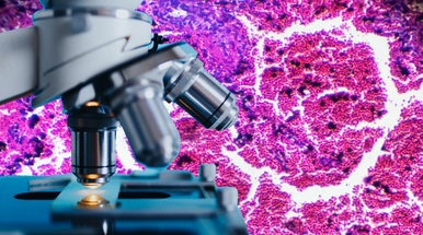 RUOLO DELLA FASE PREANALITICA NELLA GESTIONE DEI CAMPIONI DI ANATOMIA PATOLOGICA - 12 DICEMBRE 2025 (ore 14.00- 18.00)